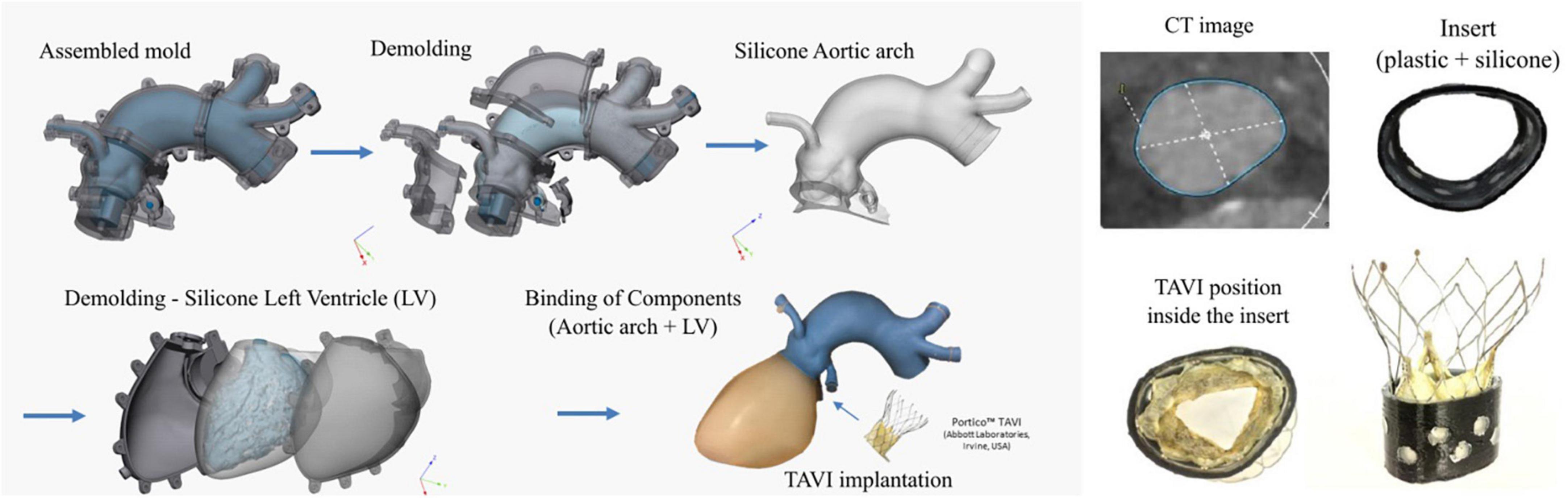 Quantification of paravalvular leaks associated with TAVI implants using 4D MRI in an aortic root phantom made possible by the use of 3D printing